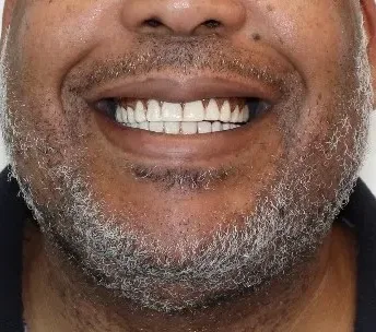 dental implants near me round rock tx