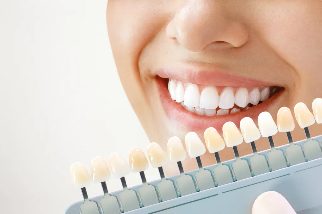 teeth whitening round rock texas