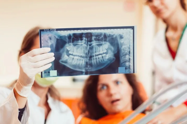 Worried About Wisdom Teeth Removal? What You Need To Know wisdom teeth removal smile solutions red rock tx